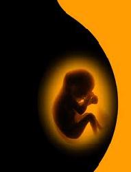 EL ABORTO